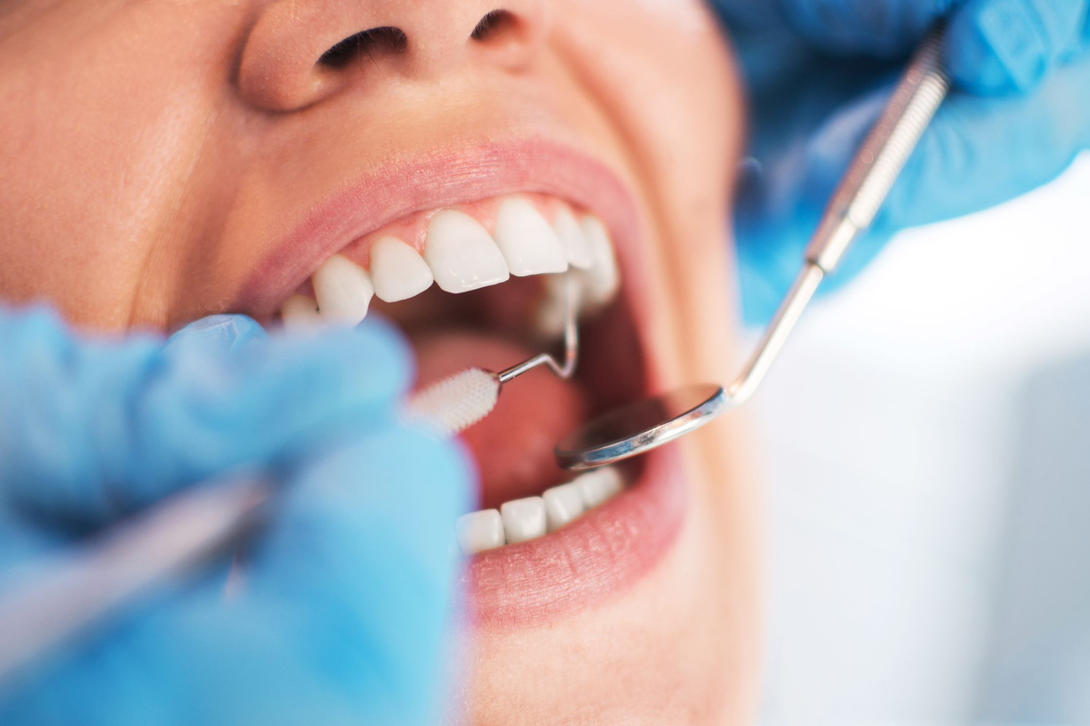 traitement endodontique mons